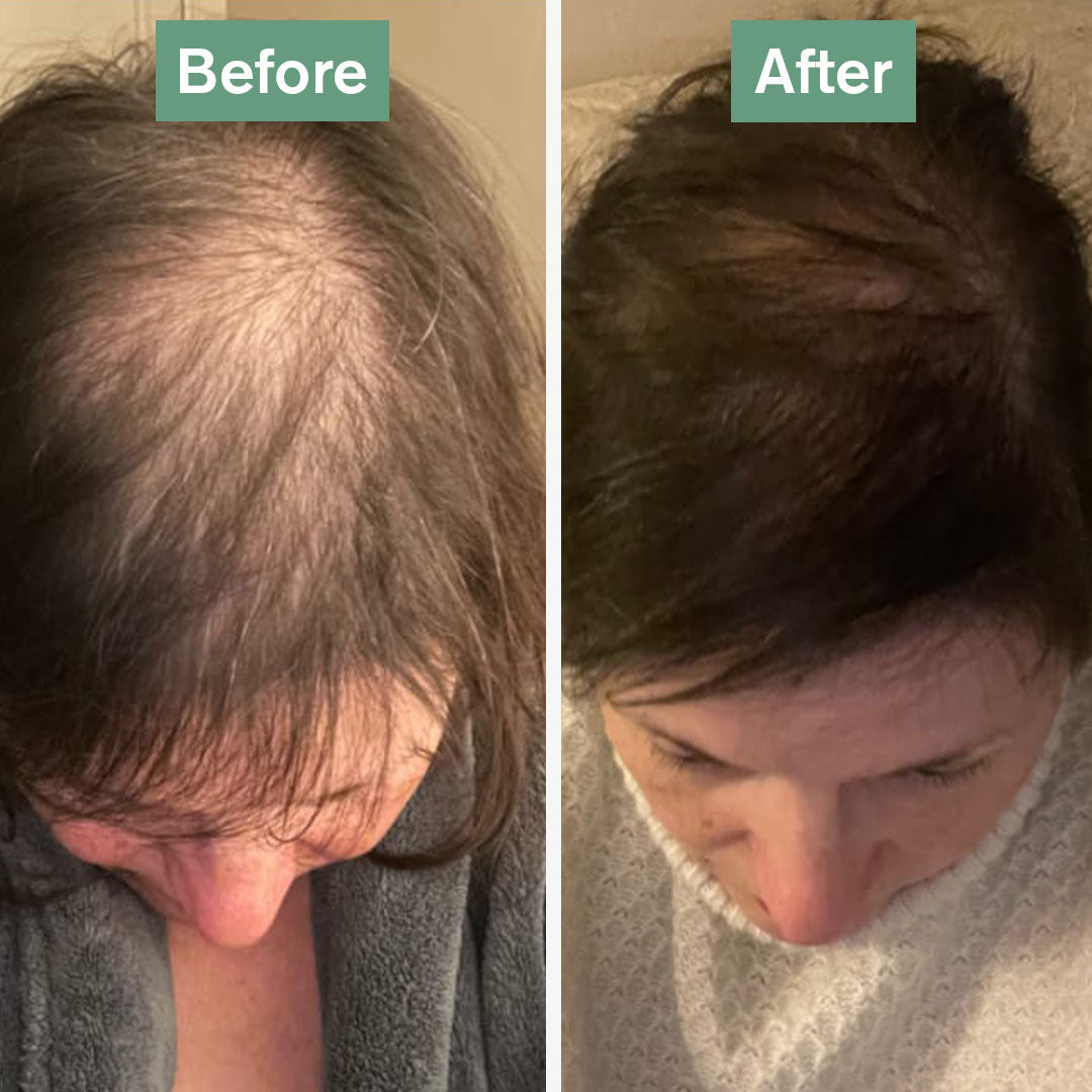 Orisvyn Hair Saviour®