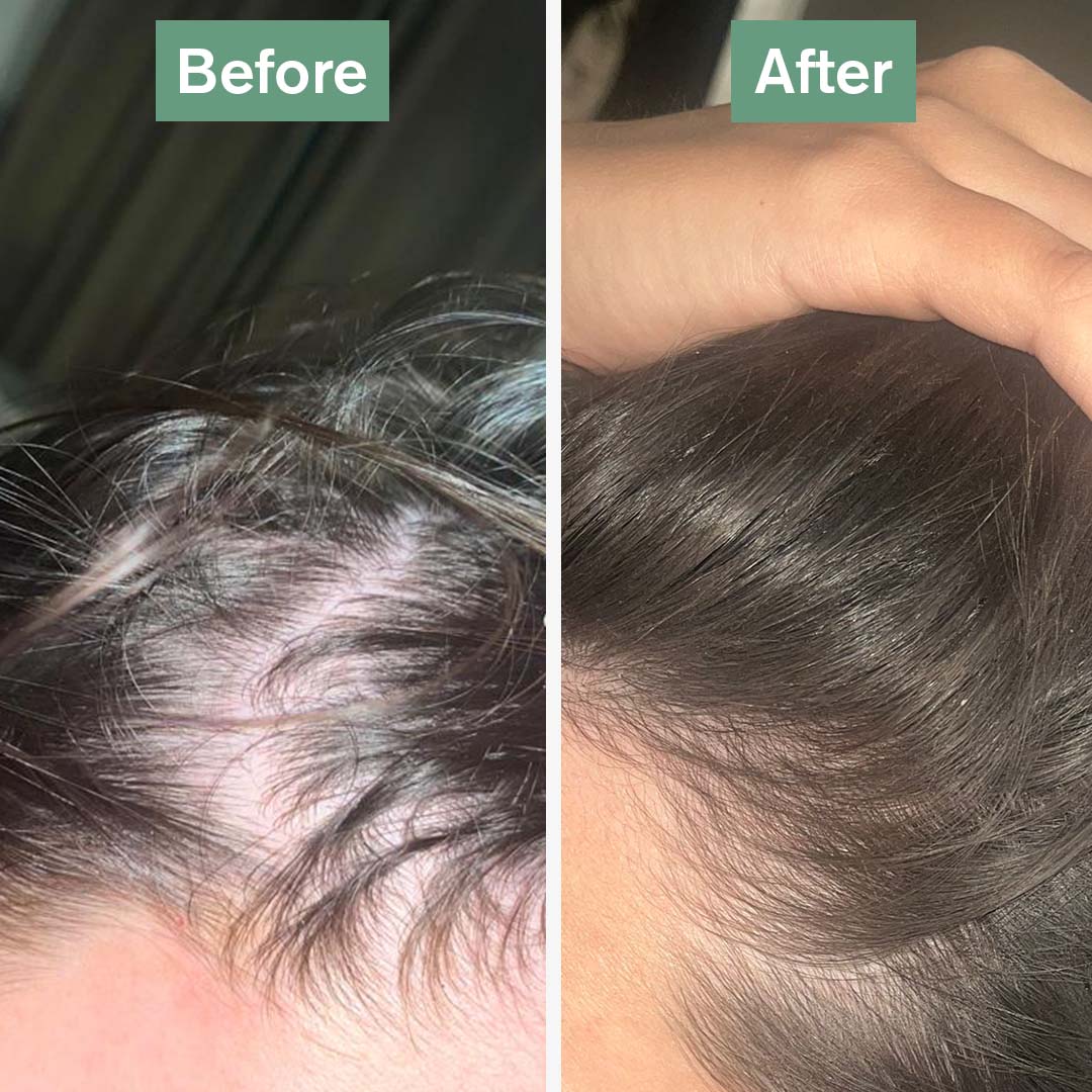 Orisvyn Hair Saviour®