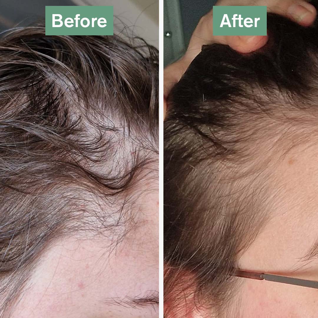 Orisvyn Hair Saviour®