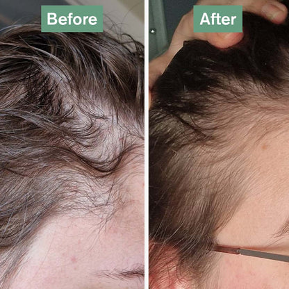 Orisvyn Hair Saviour®