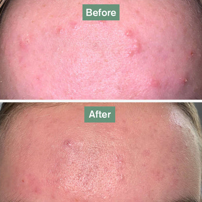 Orisvyn Skin Saviour®