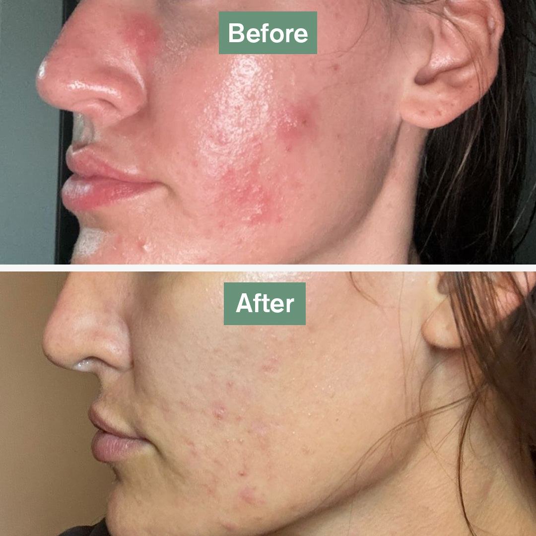 Orisvyn Skin Saviour®